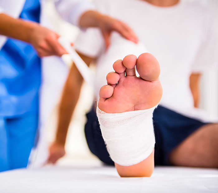 How to Treat Your Ankle Sprain