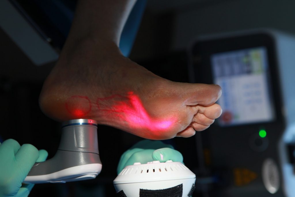 laser treatment for plantar fasciitis near me