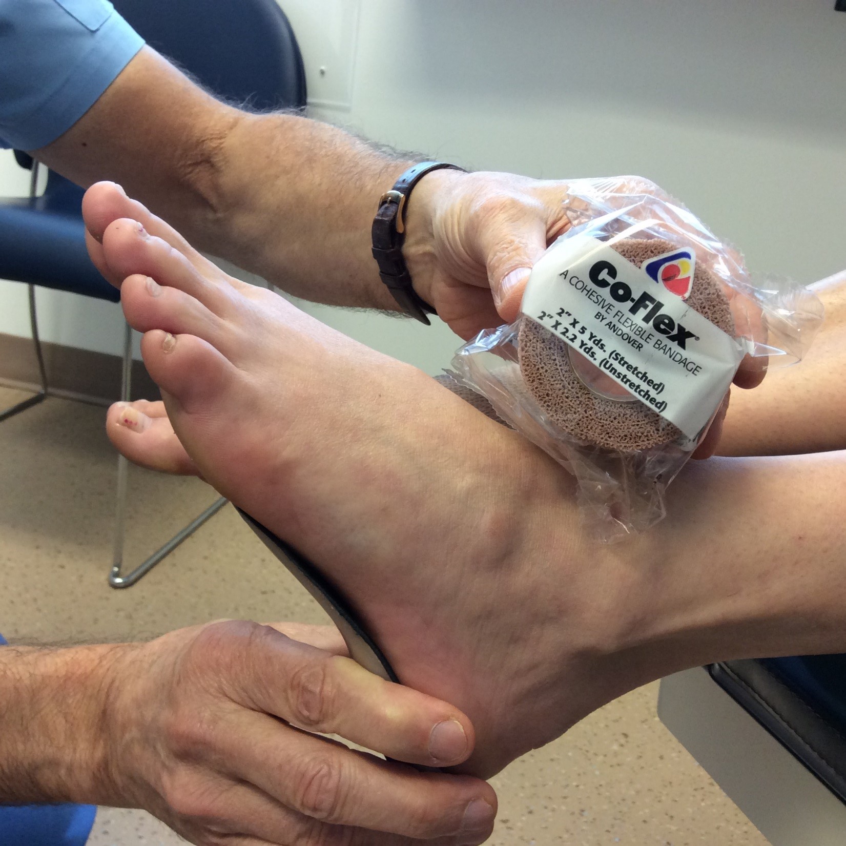 Custommade Orthotics Ottawa Foot Clinic